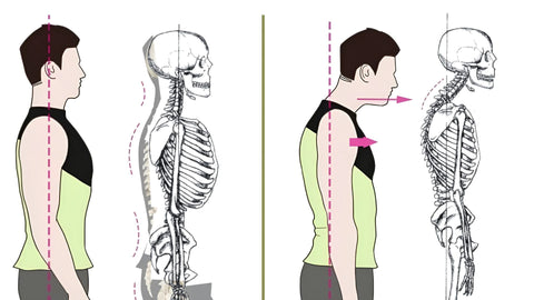 How to Fix Uneven Shoulders: A Complete Guide to Restoring Balance