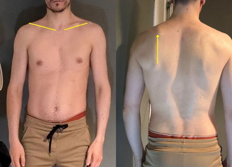 How To Fix Uneven Shoulders