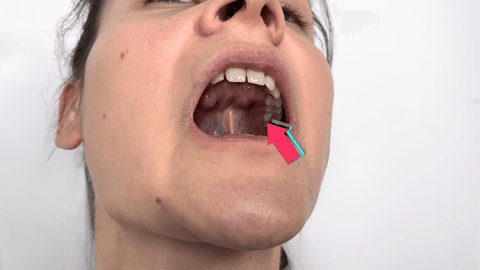 Correct jaw posture versus a misaligned jaw pulling the head forward and shifting body posture.