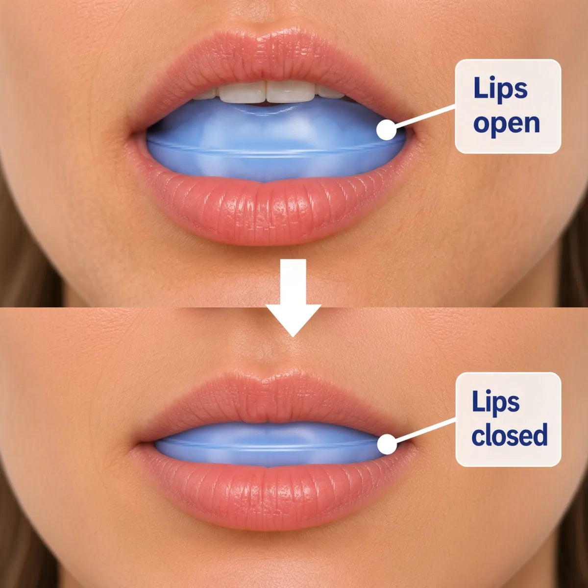 Close-up of lips around the Functional Activator mouth guard, shown open and then closed