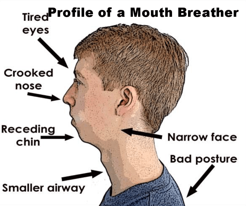 mouth-breating-vs-nasal-breating-posturepro