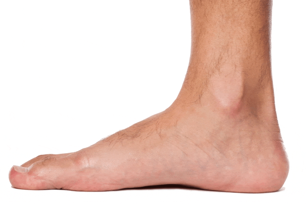 flat feet soles