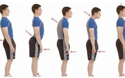Why Posture Correctors Won’t Fix Your Posture