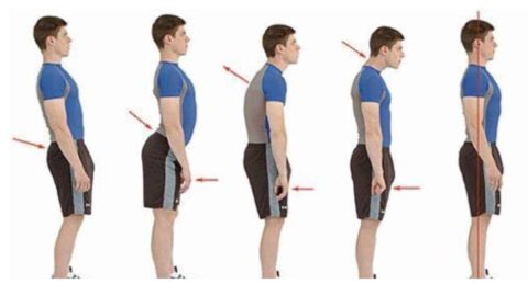 Why Posture Correctors Won’t Fix Your Posture • Posturepro
