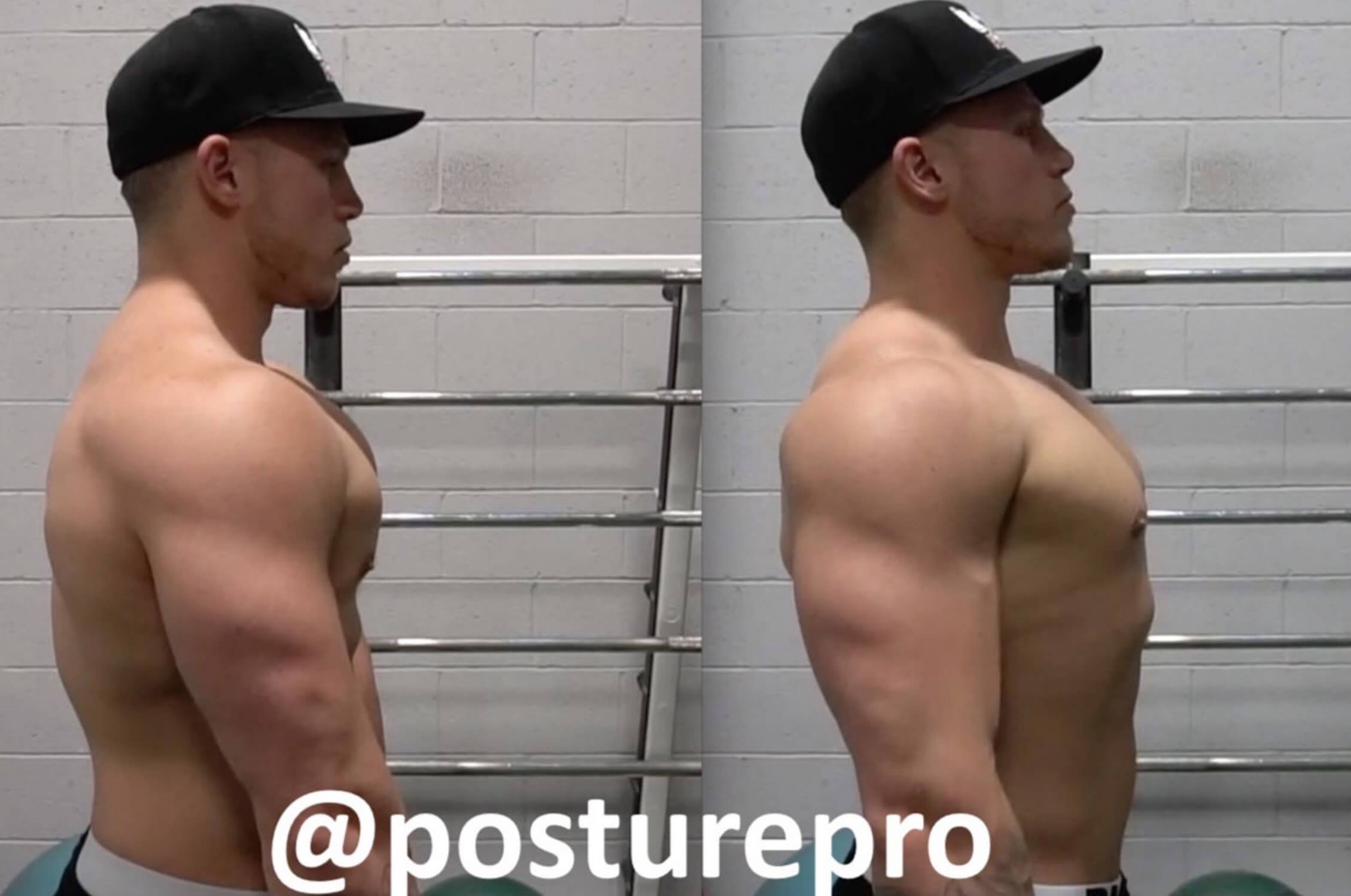 3 Exercises to Fix Rounded Shoulders | Posturepro