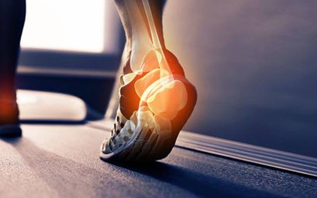 Proprioceptive Insoles: What’s the story?