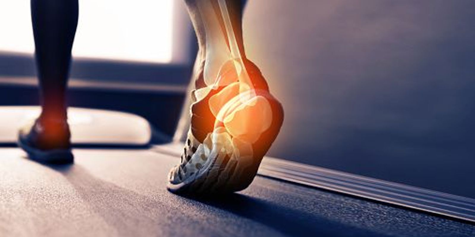 Proprioceptive Insoles: How Do They Work?