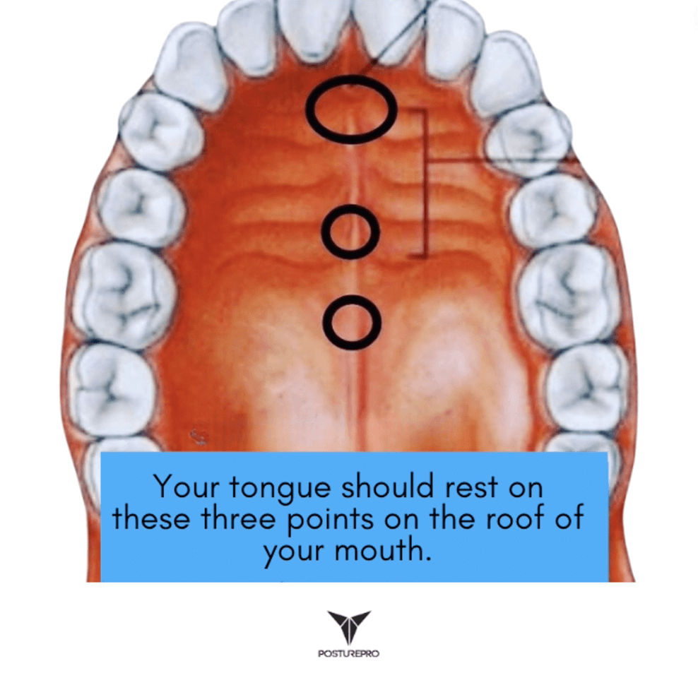 Tongue posture